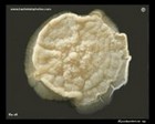 Mycobacterium colony on agar.jpg